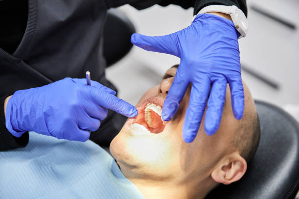 Best Chipped Tooth Repair Near Me  in Nashua, NH
